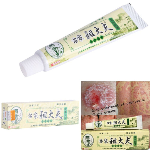 15g Psoriasis Dermatitis Eczema Treatment Anti Bacterial Skin Fungus Herbal Cream Ointment Miao ILML