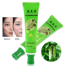 30g Acne Cream Blain Products Desalt Blain To Imprint Face Cream Face Treatment ILML