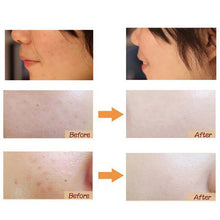 DD Cream Makeup Skin Care  Make UP Korean Cosmetics Whitening Concealer Upgrade BB Cream 30g Maquiagem ILML