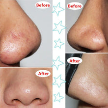 Face Mask Suction Black Head Peel Masks Deep Cleansing Tearing Blackhead Remover Purifying ILML
