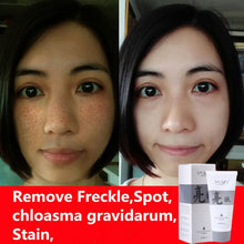 Fade Dark Spots Face Mask Whitening and Spot Removal Productoisturizing Exfoliator Anti Wrinkle Skin Care Masks 40g ILML