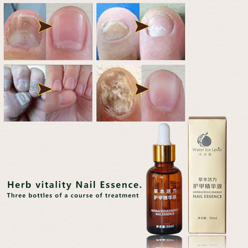 Health Skin Care Herbal Nail Repair Treatment Essential Oil Onychomycosis Remover Serum Beauty Disinfect L4 ILML