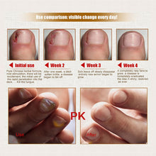 Health Skin Care Herbal Nail Repair Treatment Essential Oil Onychomycosis Remover Serum Beauty Disinfect L4 ILML