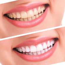 Teeth Whitening 44% Peroxide Dental Bleaching System Oral Gel Kit Tooth Whitener Dental Equipment ILML