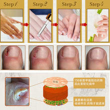 Fungal Nail Treatment Essence Nail and Foot Whitening Toe Nail Fungus Removal Feet Care Nail ILML