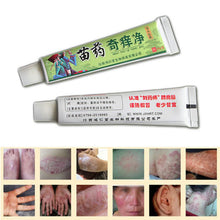 Net Herbal Itch Cream Fungal Infections Foot And Ringworm Balanitis Hemorrhoids Anti-itch Body Creams ILML