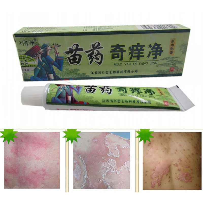 Net Herbal Itch Cream Fungal Infections Foot And Ringworm Balanitis Hemorrhoids Anti-itch Body Creams ILML