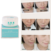 Powerful whitening Freckle cream Remove melasma Acne Spots pigment Melanin face care cream L4 ILML